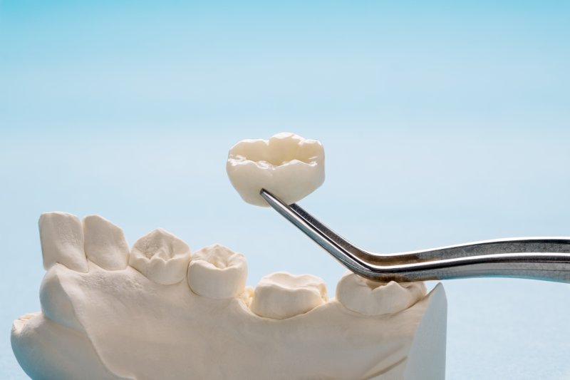 an up-close view of a dental crown